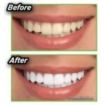 Superdrug Pro Care Charcoal Toothpaste 25ml - Image 2