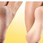 Krack Heel Repair Cream Happy Feet 15g - Image 2