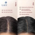 LAFZ Halal Onion Seed Essential Oil For Hair 100ml - Image 2