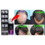 Morr F 10% Minoxidil & Finastride Lipid Solution For Topical Application 60ml - Image 2